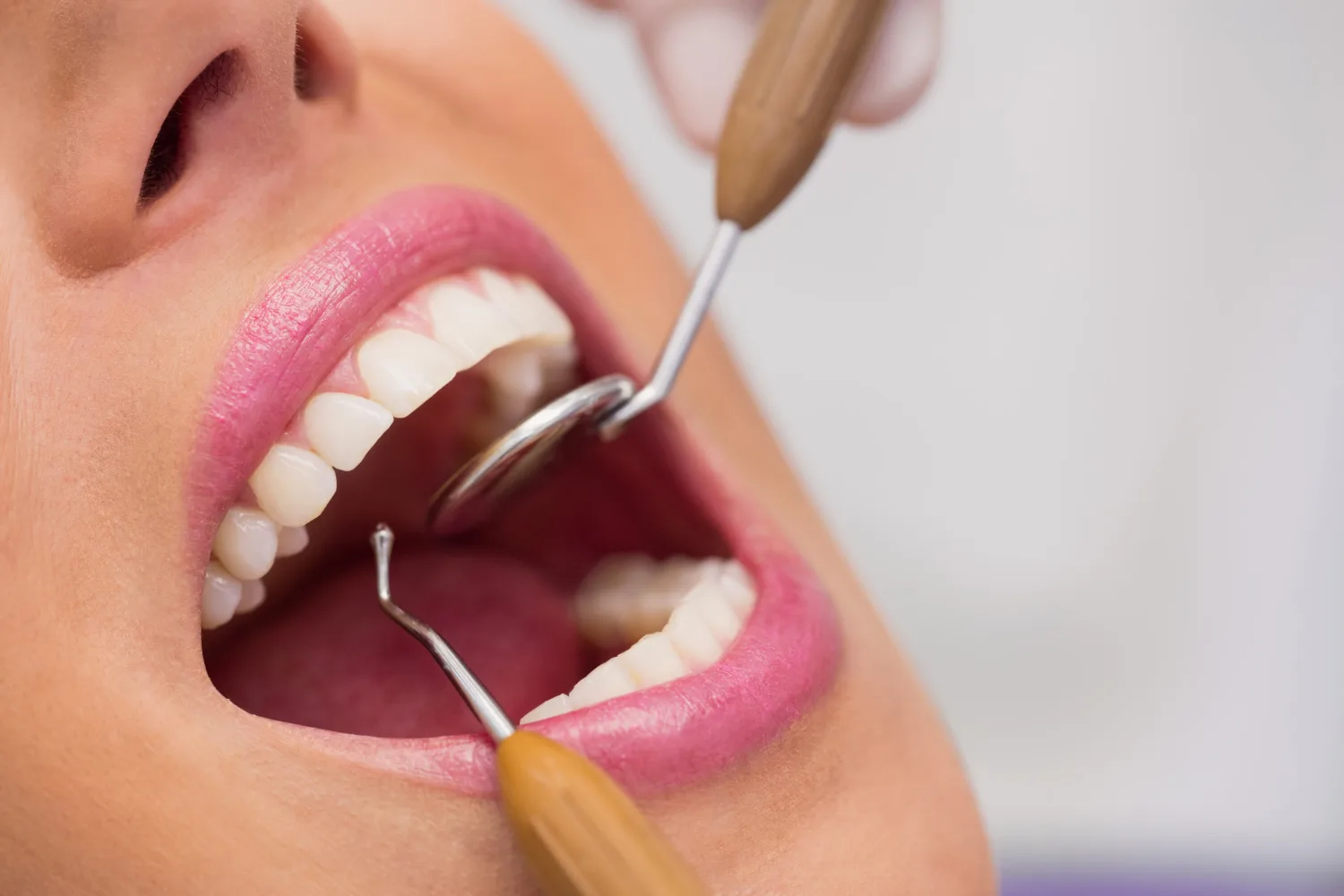 Odontología general en Iztapalapa: Tu sonrisa saludable con CS Dental